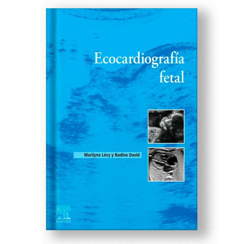 Ecocardiografía fetal 1 ed 2023