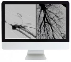 ARRS Case Review of Vascular and Interventional Radiology 2023 (Videos Only)