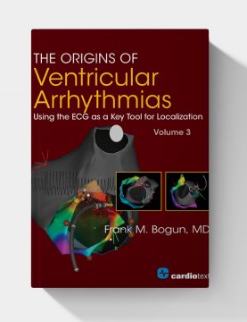 The Origins of Ventricular Arrhythmias: Using the ECG as a Key Tool for Localization, Volume 3