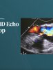 harvd-echo-wrkshop-25.jpg